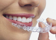 Invisalign bøjlen